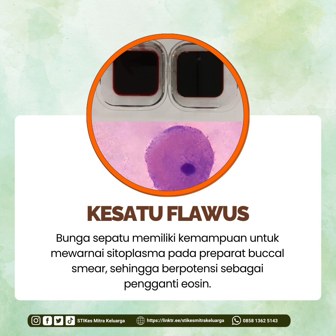 KESATU FLAWUS